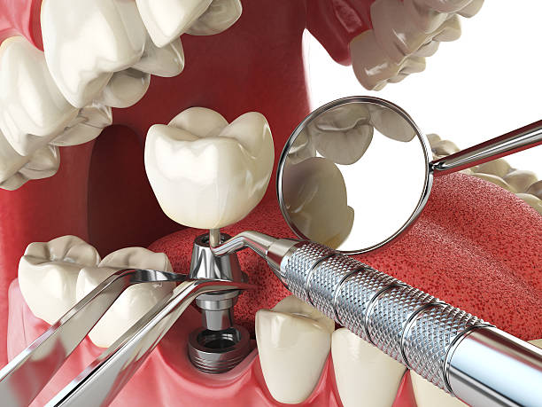 Best Same-Day Emergency Dental Services in Cherry Hill, VA