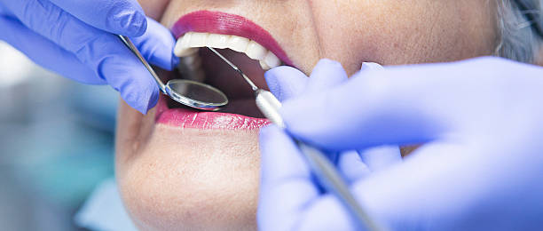 Best Emergency Tooth Extraction in Cherry Hill, VA